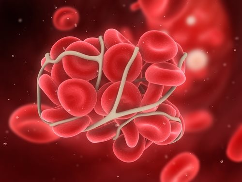 Xarelto Approved to Treat and Reduce Blood Clots